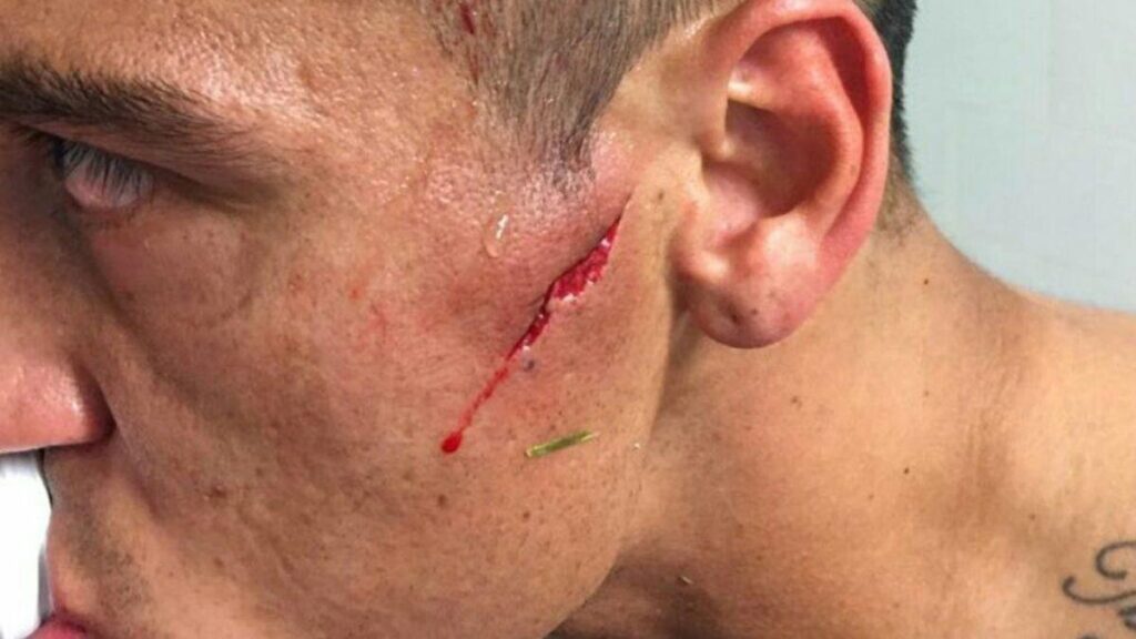 The Brutal Injuries You’ll See During a Mass Shooting and How to Treat Them